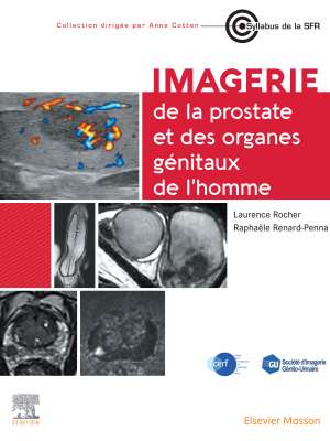 prostate rocher 2025