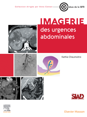 urgences abdominales 2025