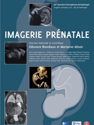 cover imagerie prenatale