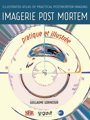 cover imagerie post mortem
