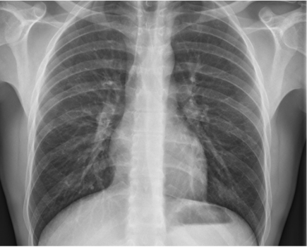 Quel avenir pour l’imagerie thoracique dans les 10 ans ?