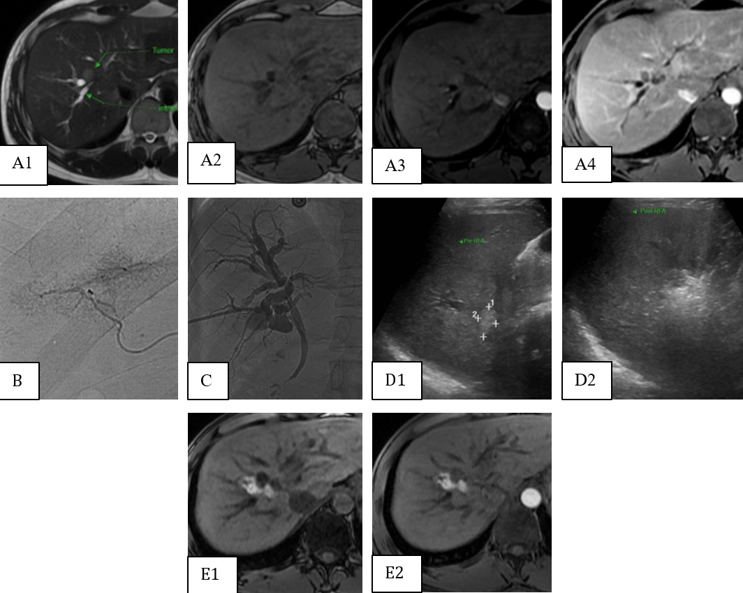 fig1