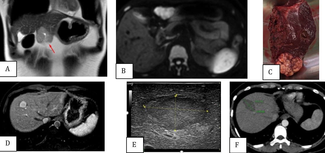 fig2