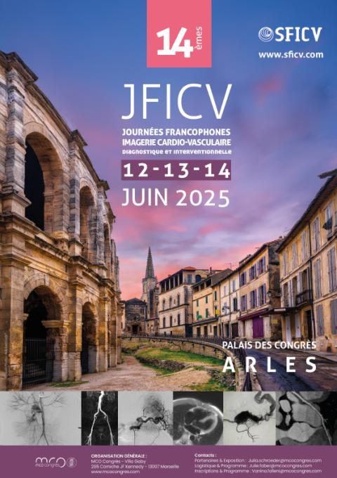 JFICV
