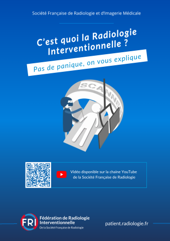 C'est quoi la RI