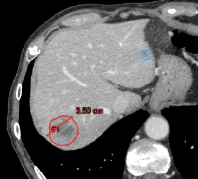 Capture d’écran 1 Article SFR retour d'expérience ECR.png