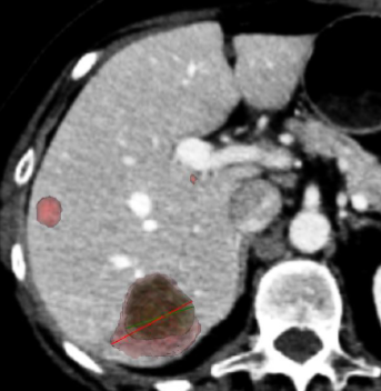 Capture d’écran 2 Article SFR retour d'expérience ECR.png