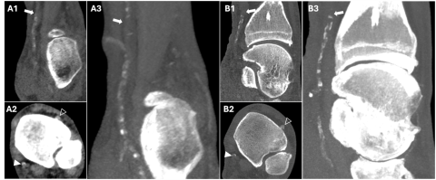 Image1 sfr actu poster spcct.png