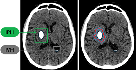Image2 clotide ruesh.png