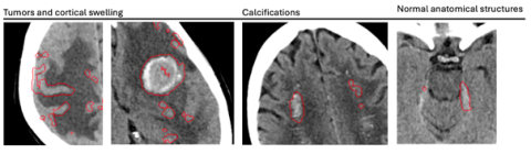 Image4 clotide ruesh.png