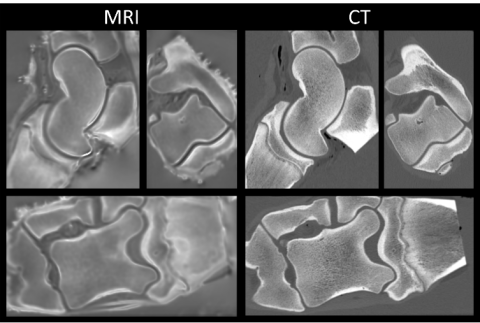 MRI-CT.png