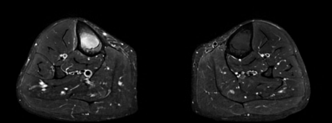 Séquence axiale 2.png