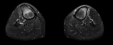 Séquence axiale.png