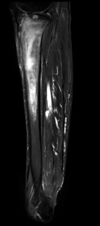 Séquence sagittale.png