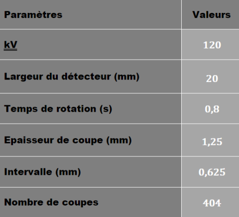 Tableau des paramètres TDM  